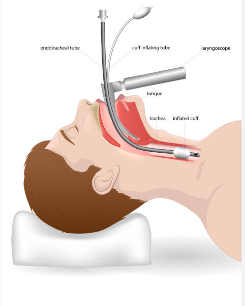 LARYNGOSCOPY - SURYA DIAGNOSTIC CENTER